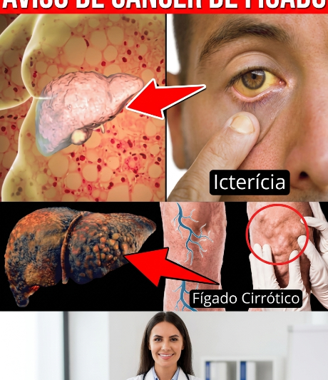11 Sinais Precoces de Câncer no Fígado Que Você Nunca Deve Ignorar