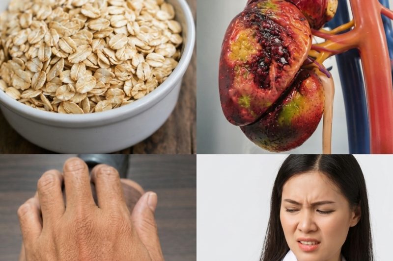 13 Alimentos Que Você Deve Evitar se Tem Creatinina Alta Para Proteger a Saúde dos Rins