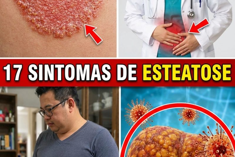 O Seu Fígado Está Sofrendo em Silêncio? 17 Sinais de Fígado Gorduroso Que Você Nunca Deve Ignorar