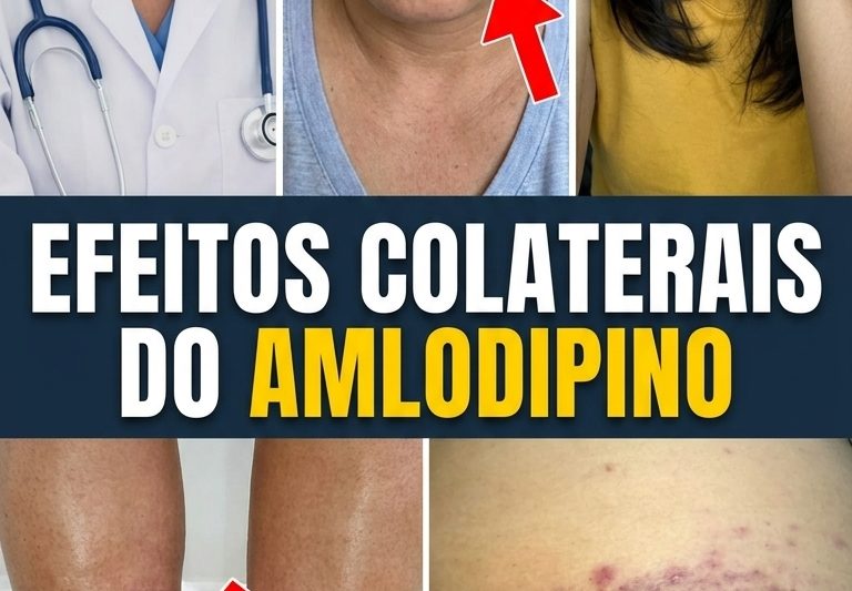 Top 12 Efeitos Colaterais da Amlodipina Que Quase Ninguém Comenta