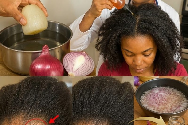 Suco de Cebola para Cabelos Saudáveis: O Que a Ciência Realmente Diz Sobre Esse Remédio Caseiro