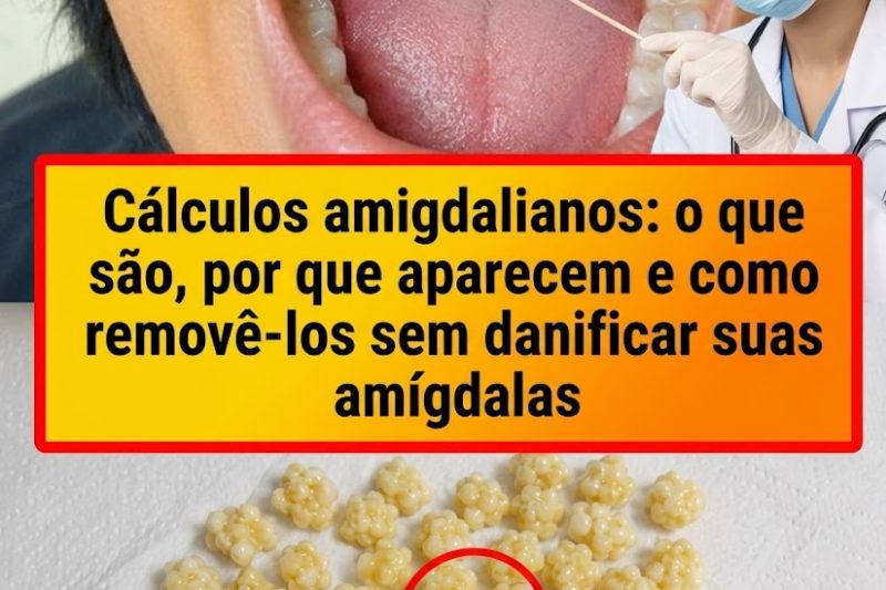 Por Que Pequenas Pedras Brancas e Malcheirosas Aparecem na Sua Boca?